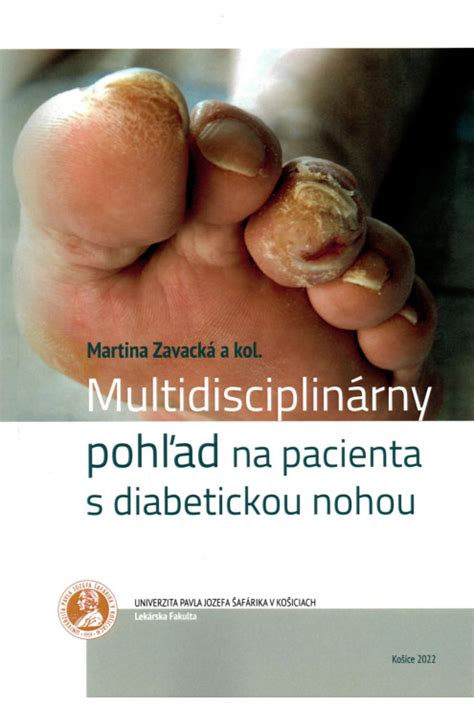 Pacient s diabetickou nohou