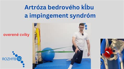 Osteosyntéza bedrového kĺbu