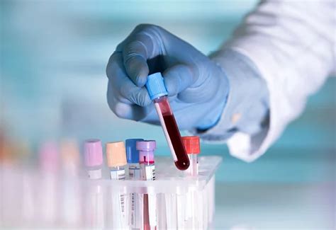 Laboratórne vyšetrenia krvi a moču