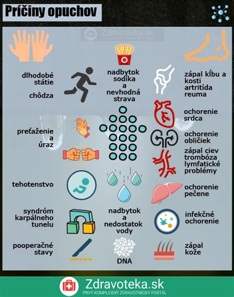 Tabuľka: Prehľad príčin opuchnutých prstov