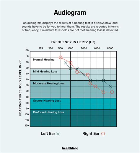 Audiogram s vysvetlením