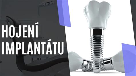 Schéma kochleárneho implantátu