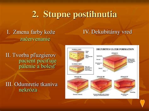 Stupne preležanín