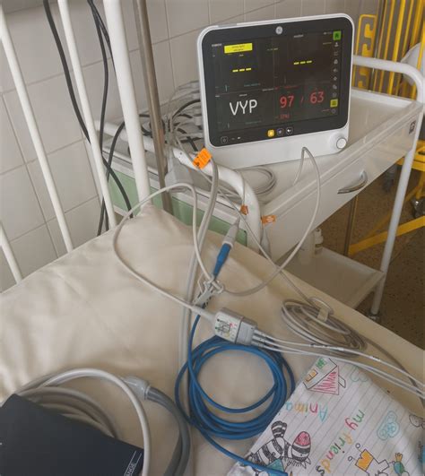 Schematické znázornenie monitorovania vitálnych funkcií dieťaťa po operácii