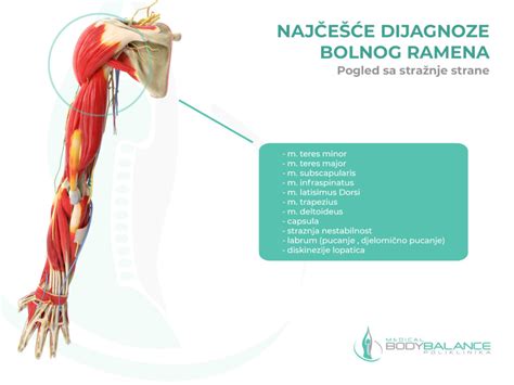 Infografika: Príznaky vykĺbeného ramena