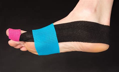 Ukážka tejpovania hallux valgus