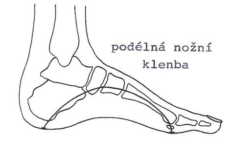 Schéma plantoskopického vyšetrenia nohy