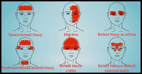 Rôzne typy škál na hodnotenie bolesti