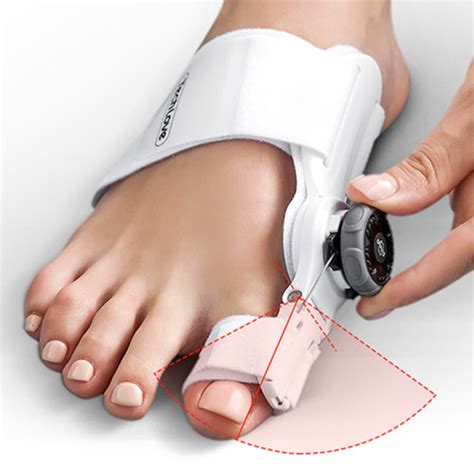Hallux valgus - vybočený palec na nohe