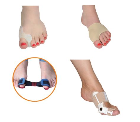 Infografika: Príčiny vzniku Hallux Valgus