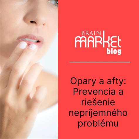 Príčiny afty a ich prevencia