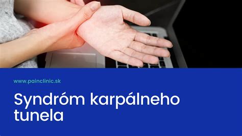 Tabuľka: Príznaky syndrómu karpálneho tunela a ich priebeh