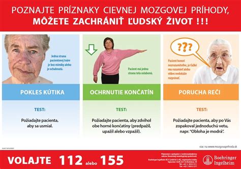 Znaky cievnej mozgovej príhody