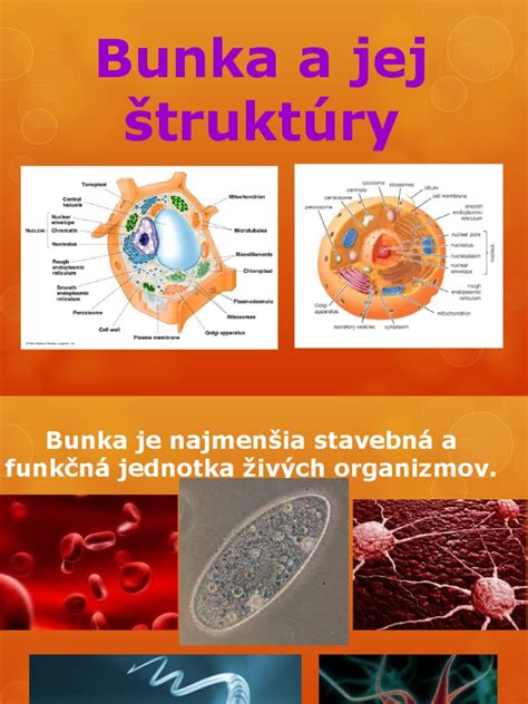 Ilustrácia štruktúry prsníka s vyznačeným nádorom