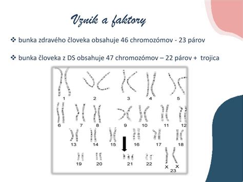 Schéma chromozómov človeka s trizómiou 21