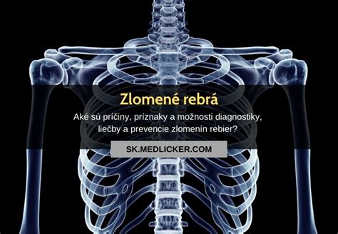 Ilustrácia bolesti pri zlomenine rebier