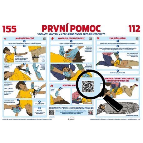 Schéma opatrení v projekte 