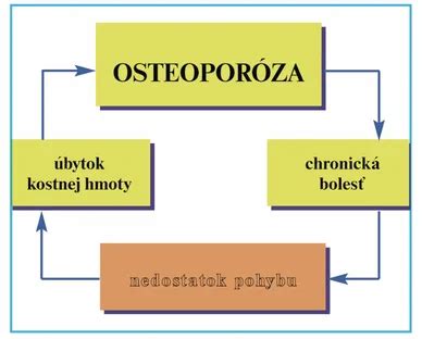 Prehľad rizikových faktorov osteoporózy