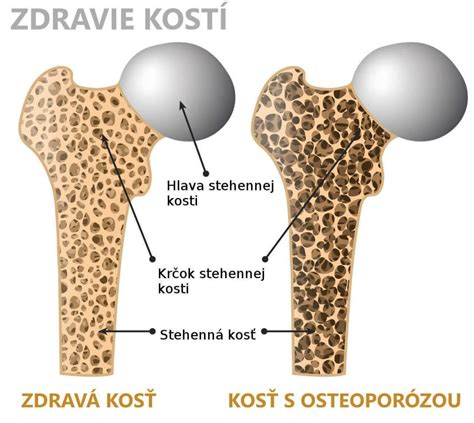 Štruktúra stehennej kosti a jej kĺbov