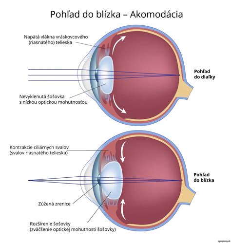 Obrázok ľudského oka s popismi rôznych diagnóz