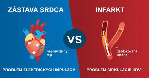 Liečba infarktu myokardu