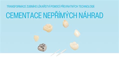 Prehľad úhrad zubných náhrad poisťovňami