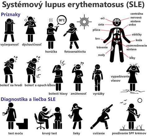 Príznaky a diagnostika lupusu