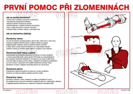 Infografika: Metódy fyzikálnej terapie pri zlomeninách