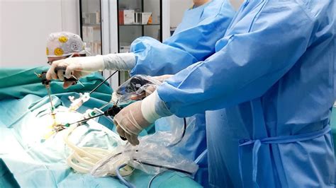 Schéma: Laparoskopická operácia žlčníka s vyznačenými rezmi a nástrojmi