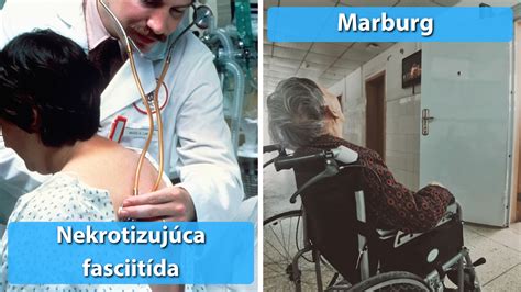 Top 6 kategórií chorôb spôsobujúcich čiastočnú invaliditu