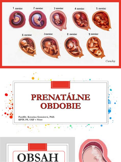 Infografika príčin viacnásobného postihnutia: prenatálne, perinatálne a postnatálne faktory