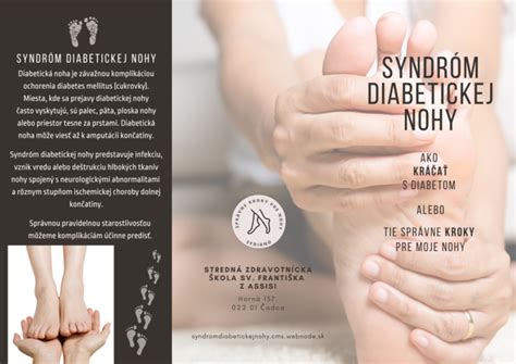 Ilustrácia diabetickej nohy a poškodenia nervov