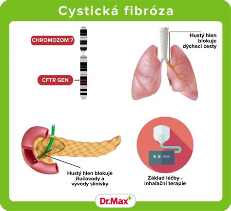 Infografika: Nové diagnózy v detskom poistení (autizmus, anorexia, cystická fibróza)