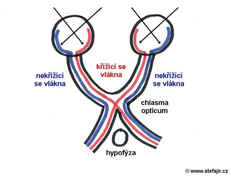 Schéma kategórií zrakového postihnutia