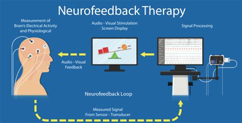 EEG Neurobiofeedback