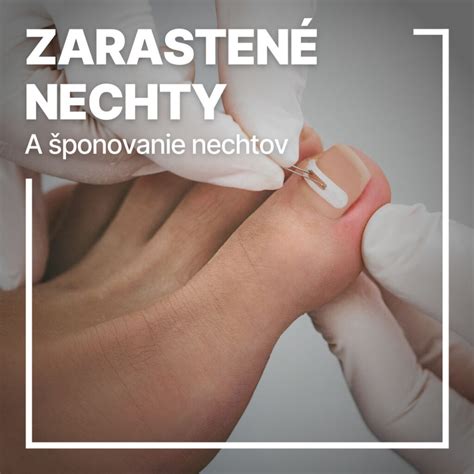 Ilustrácia rôznych tvarov nechtov