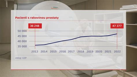 Graf spokojnosti pacientov s nemocnicami