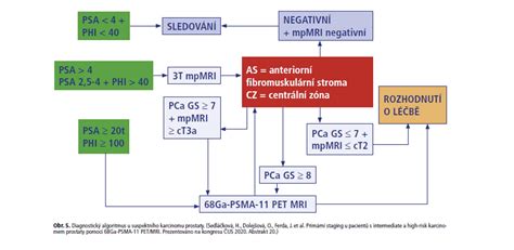 Diagnostický algoritmus SM