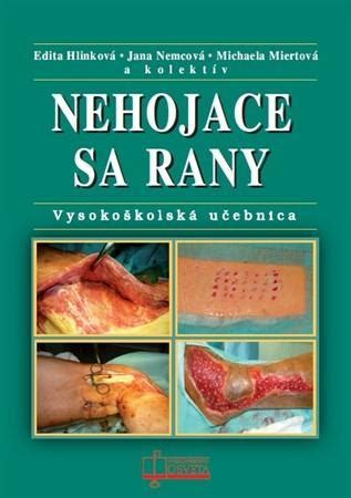 Schéma štruktúry učebnice Nehojace sa rany