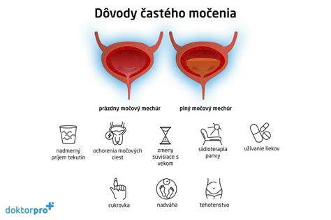 Ilustrácia ženy používajúcej pomôcku na močenie v stoji