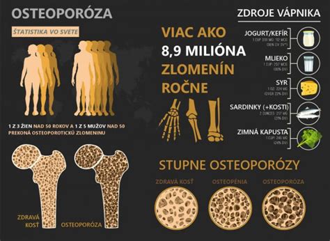 Infografika znázorňujúca rôzne stupne postihnutia pri cervikálnej myelopatii