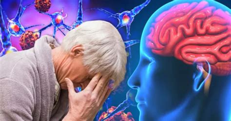 Štruktúra mozgu a prejavy Alzheimerovej choroby