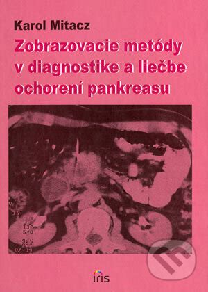 Zobrazovacie metódy v diagnostike neurologických ochorení