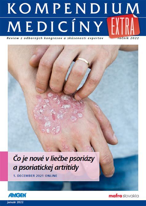 Ilustrácia rôznych typov psoriatickej artritídy