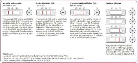 Domáci test na kandidózu pomocou slín