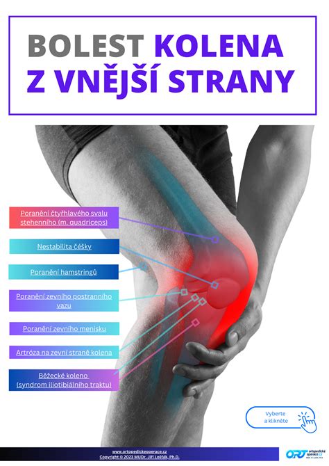 Infografika: Možnosti liečby bolesti kolena