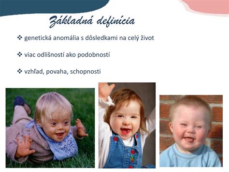 Charakteristika ľahkej mentálnej retardácie