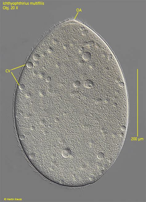 Mikroskopický záber na parazita Ichthyophthirius multifiliis