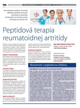 Schéma liečebných postupov pri reumatoidnej artritíde