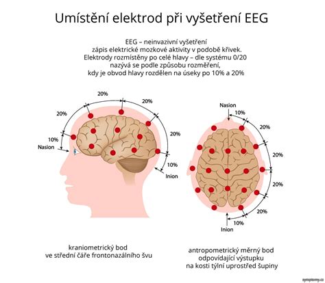 Záznam EEG aktivity mozgu
